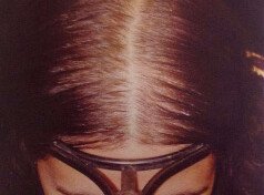 Quando a Saúde Capilar Revela o que o Corpo Silencia